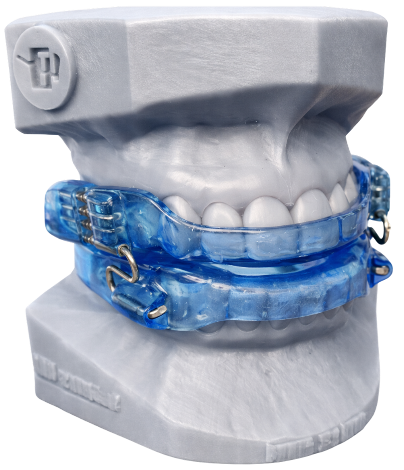 Aparelho Intraoral para Apneia do Sono
